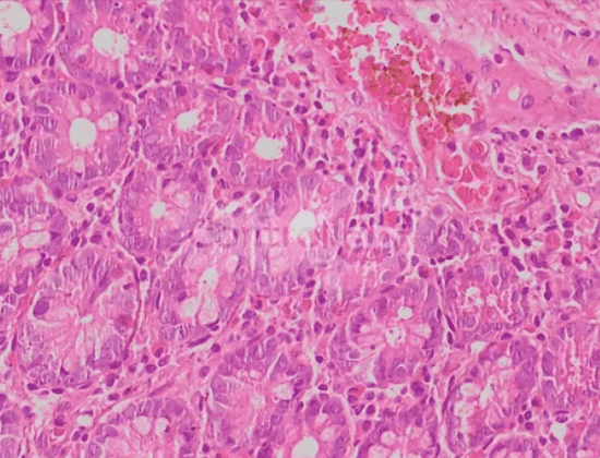 Anatomia Patológica: Guia de Livros para Graduação Médica